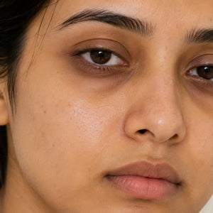 Why Your Skin Still Looks Tired Even After Using Skincare Products