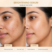 Migen Brightening Serum
